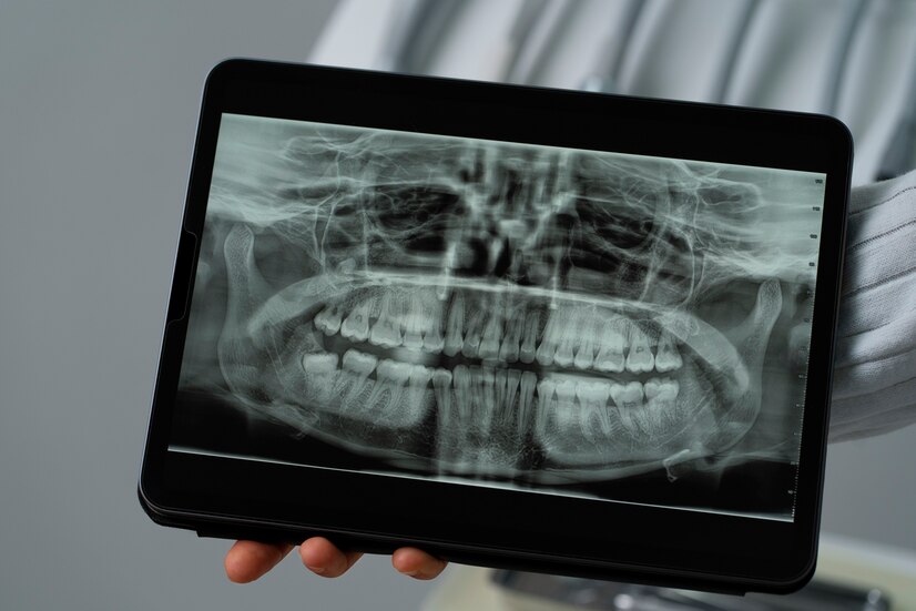XRAYS  IMAGING