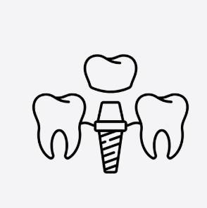 DENTAL IMPLANTS PLACED